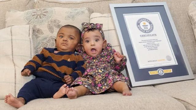 World's most premature twins: Canadian twins given '0% chance of survival' celebrate 1st birthday