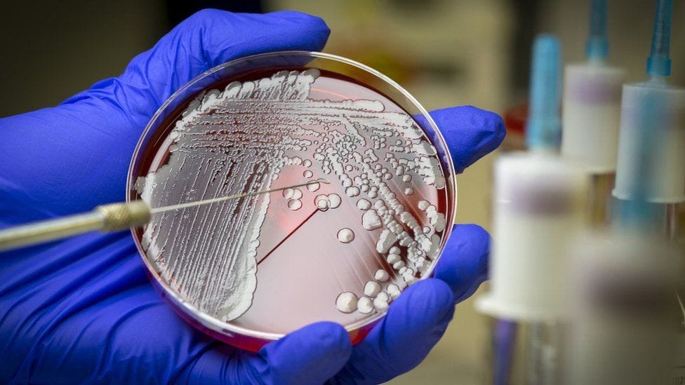 Scientists use AI to discover new antibiotic to treat deadly superbug