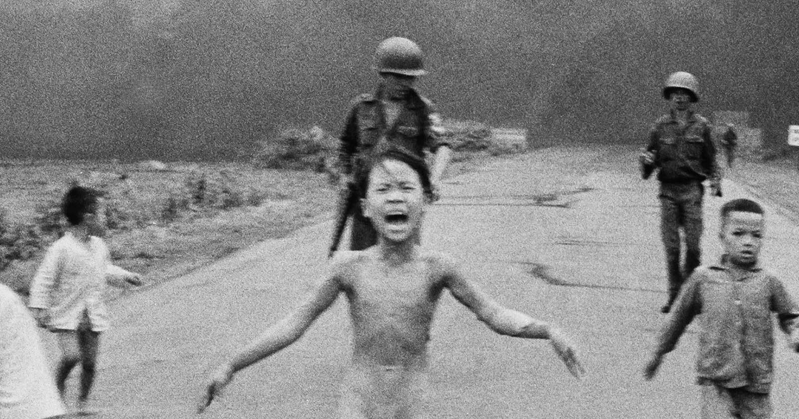 Vietnamese 'Napalm Girl' gets final skin treatment 50 years after the iconic photo
