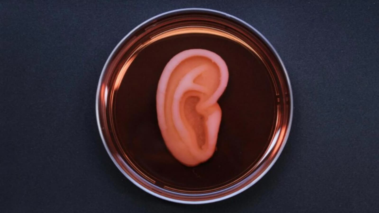 In a first, a patient receives 3-D printed ear implant made from her own cells