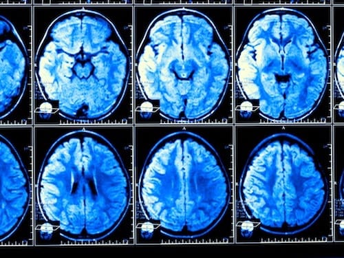 Human brain size increasing over successive generations: Study