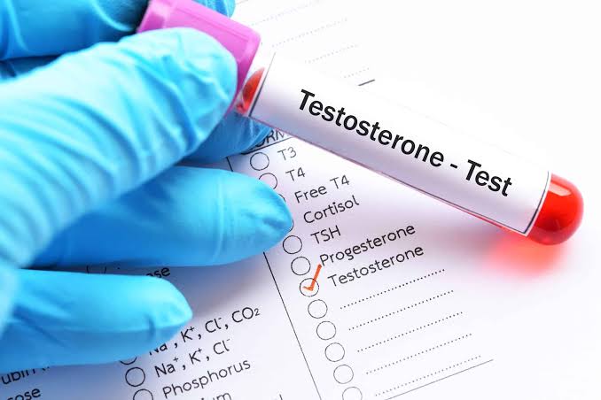 Who Requires a Testosterone Test?