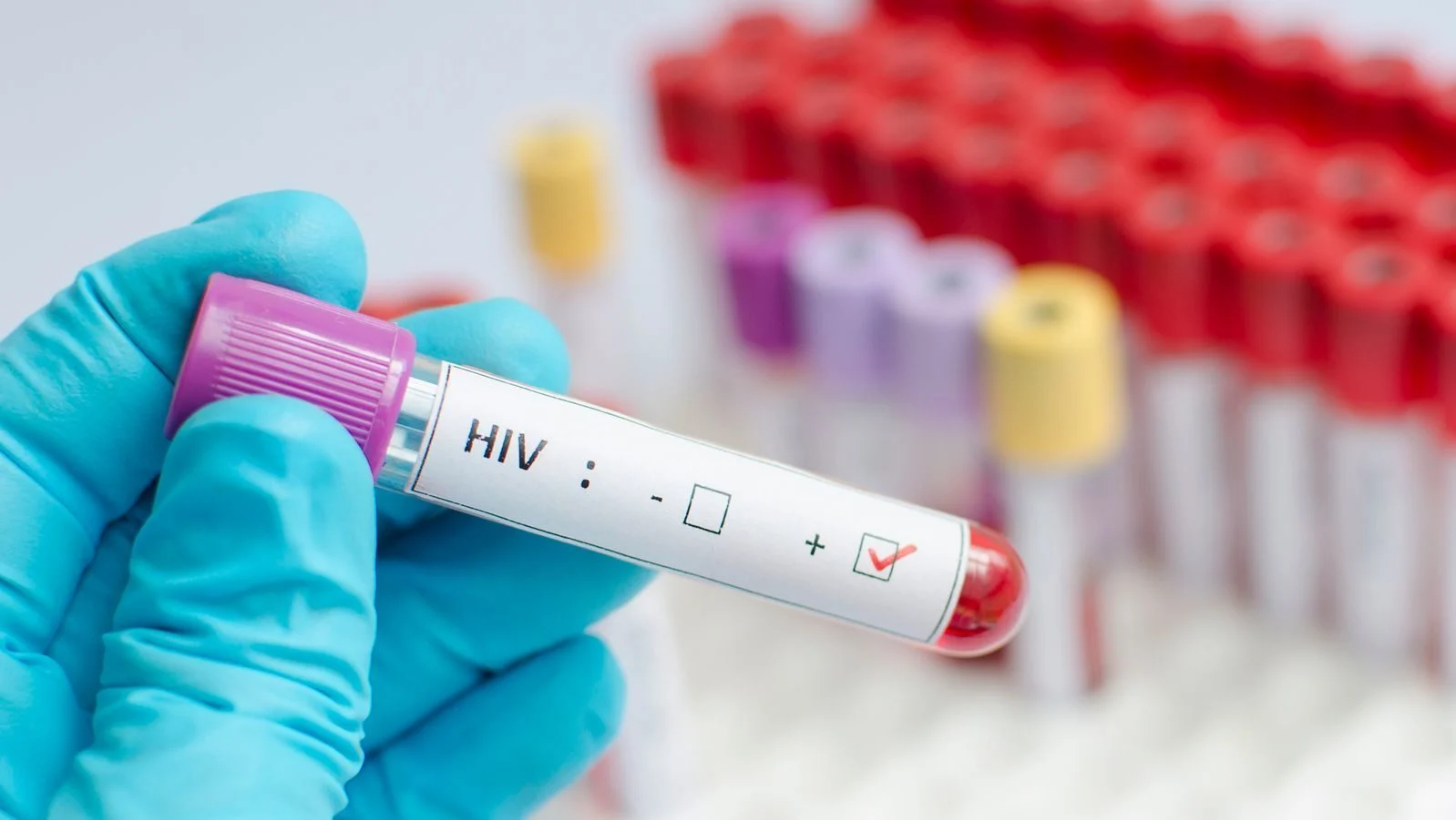 In a rare case, a woman with HIV has ‘cleared’ the virus without treatment