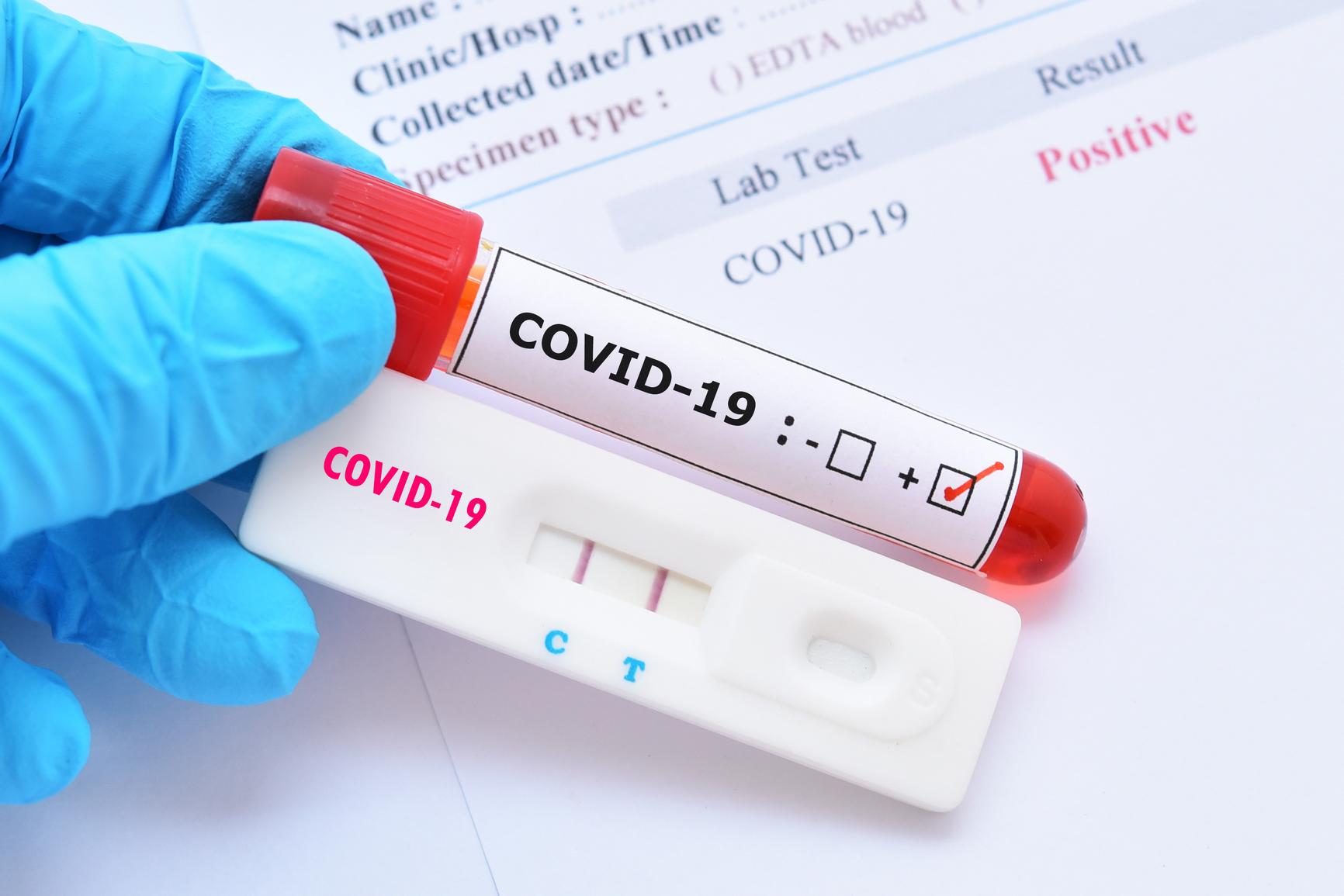 Australia: Hundreds given false COVID-19 results in Sydney lab error