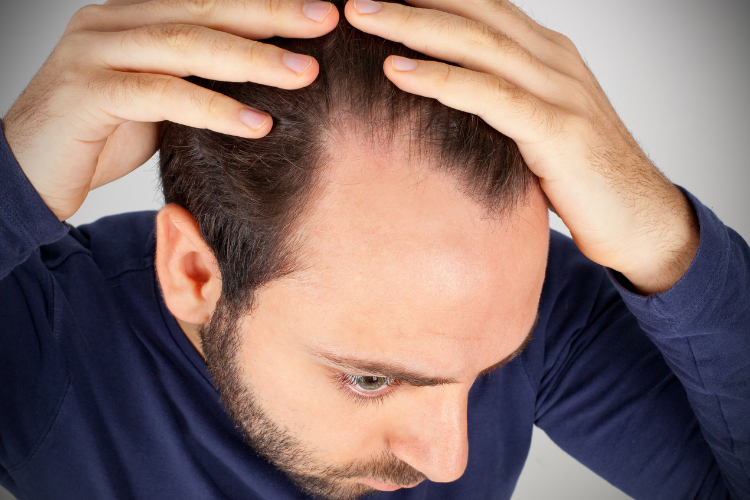 How Do You Know It’s Time to Get a Hair Replacement? Top 3 Signs New Report from Folicure Hair Dallas