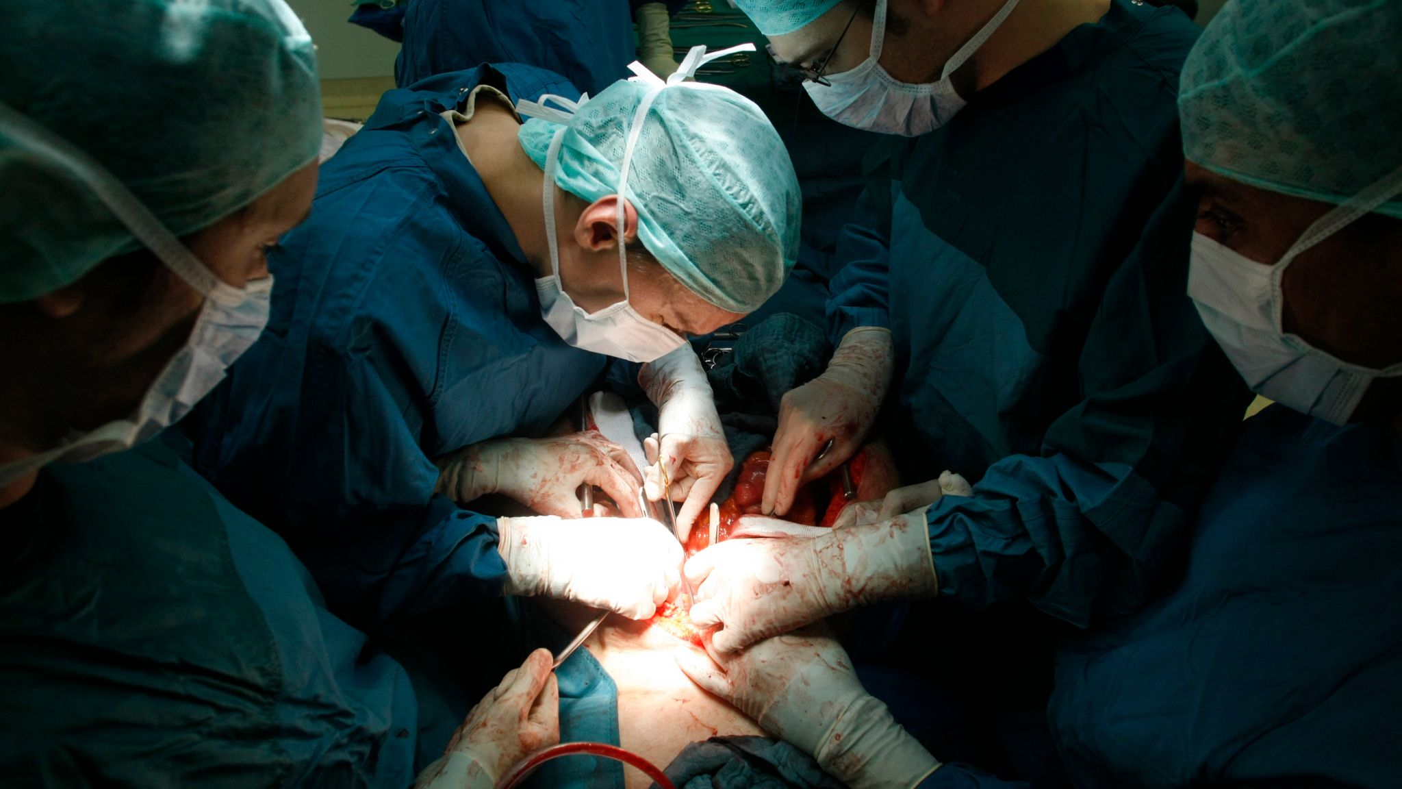 New research claims China is taking organs from living prisoners for transplantation