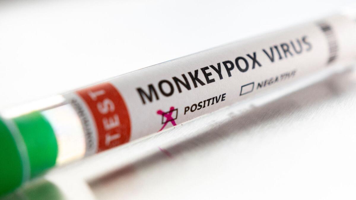 Monkeypox: Which countries have reported cases of the viral disease