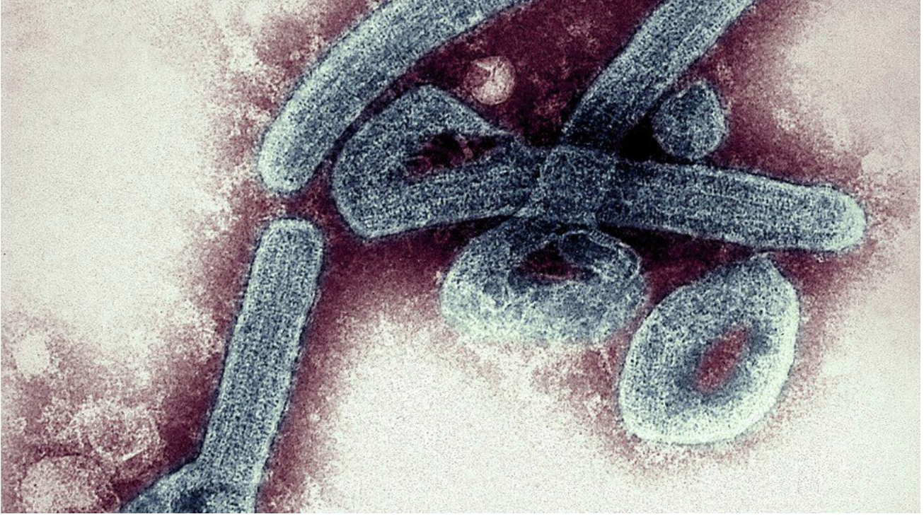 Breezy Explainer: What is the deadly Ebola-like Marburg virus disease reported in Ghana?