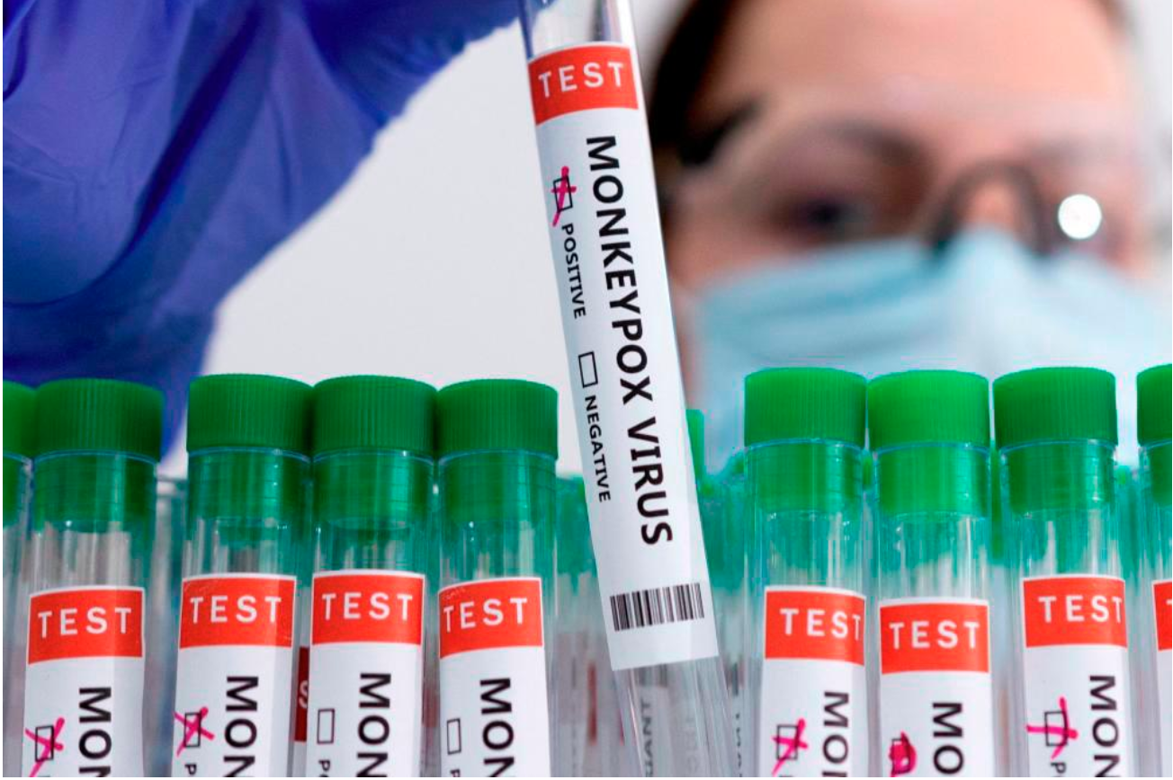 California and Illinois declare states of emergency over the monkeypox outbreak