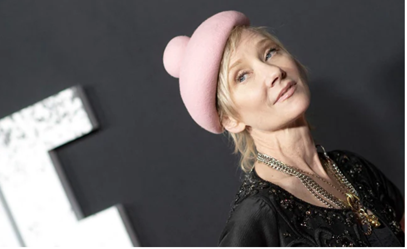 Anne Heche passes away, actress taken off life support after being declared brain dead