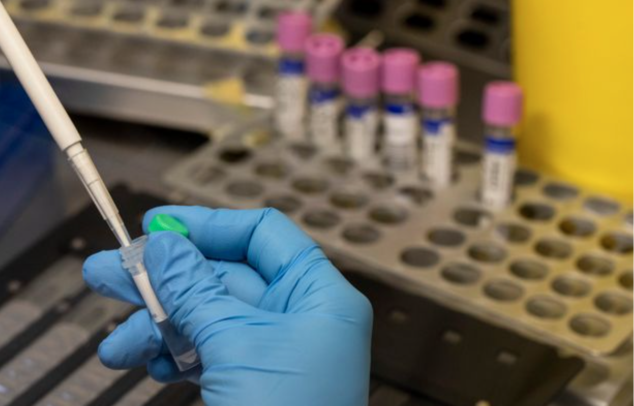 Italy: Man tests positive for COVID-19, monkeypox & HIV at the same time