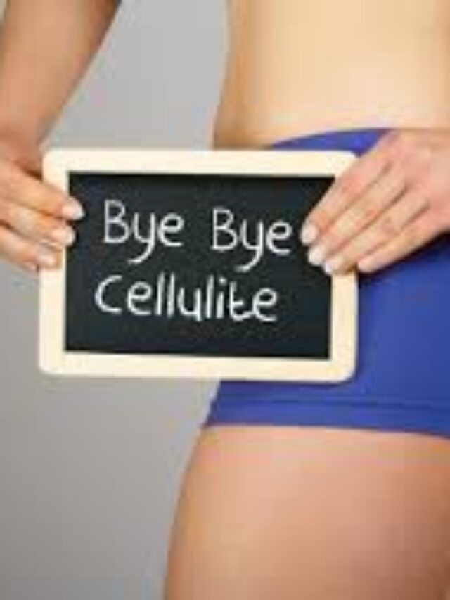 celulite