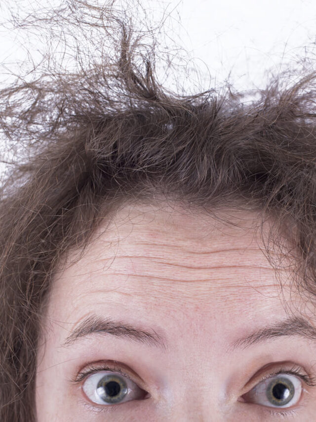 frizzy hair