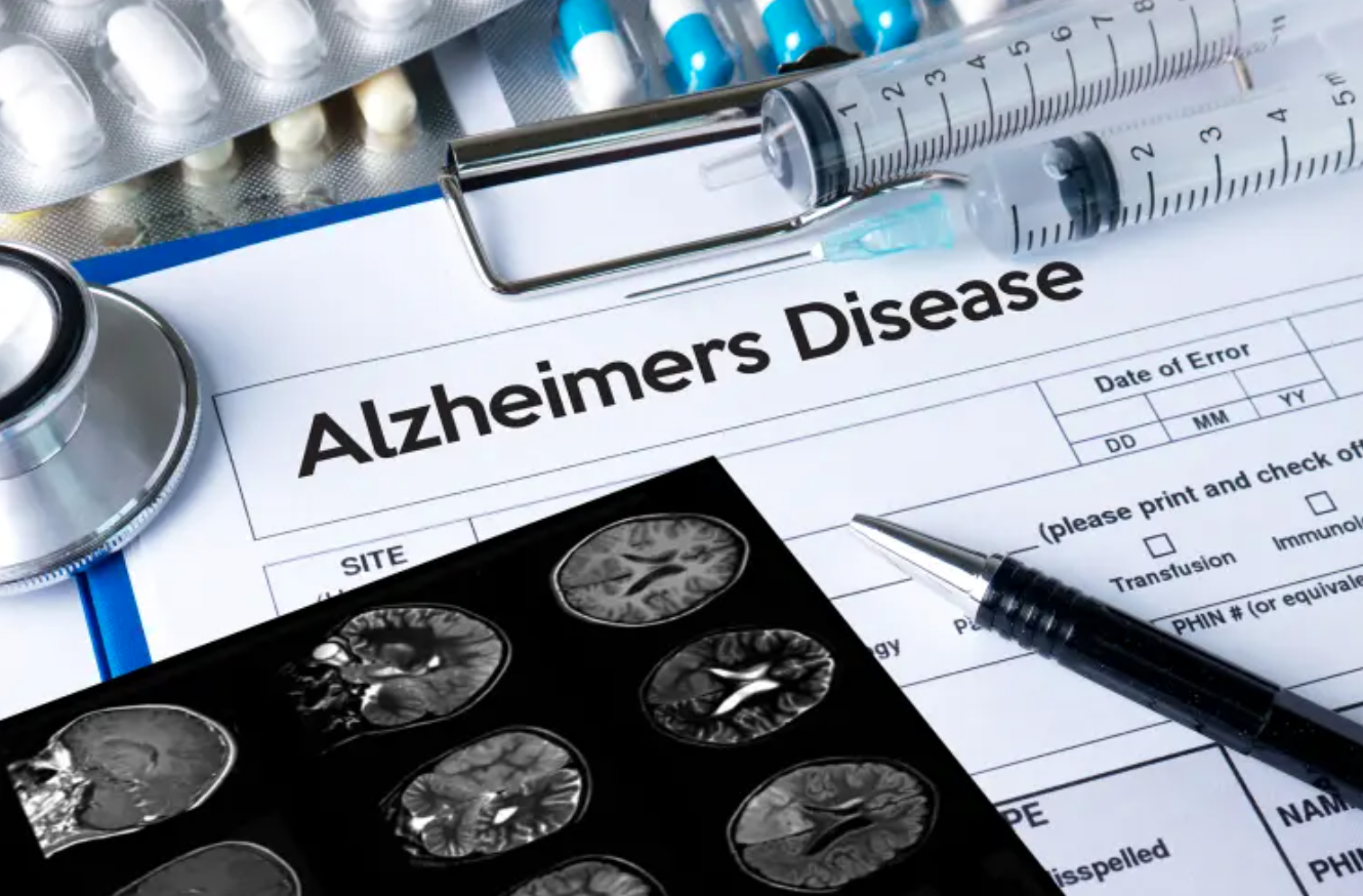 Lecanemab: US FDA approves new ‘breakthrough’ medicine for Alzheimer’s