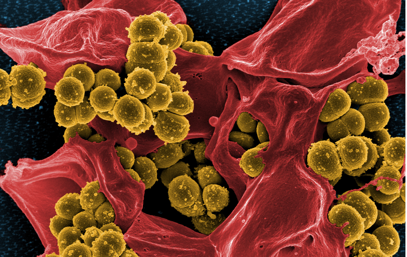 By 2050 superbugs may be as big a killer as cancer is today: Report