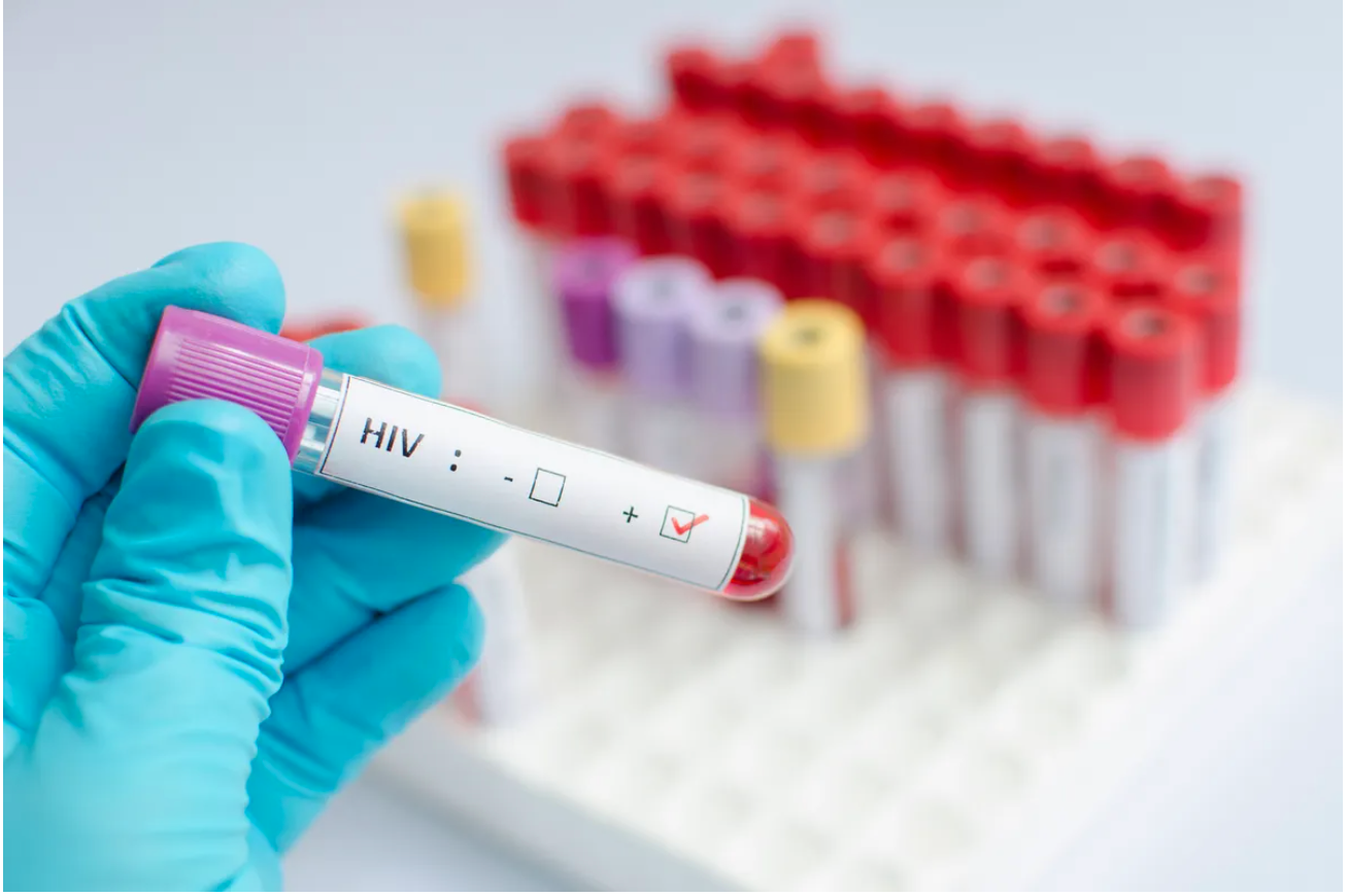 Third person cured of HIV after receiving stem cell transplant treatment
