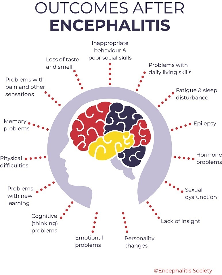 New Peer-Reviewed Research in the Journal of Neuropsychiatry and Clinical Neurosciences links Encephalitis to Depression