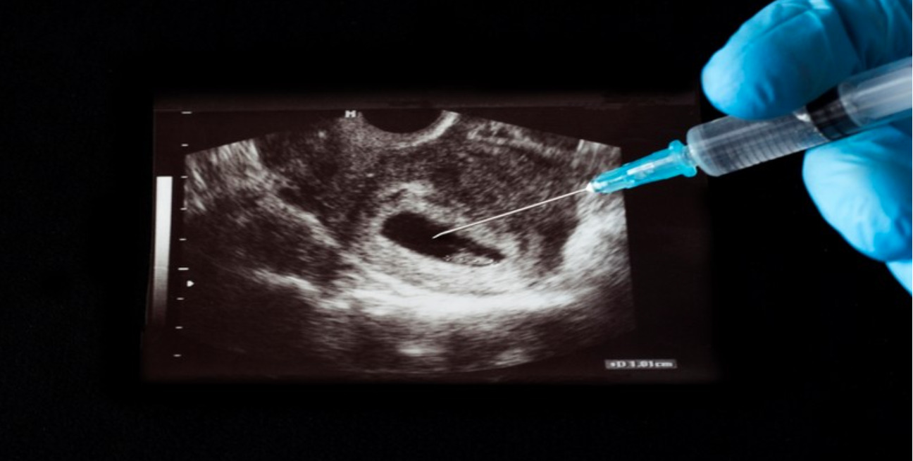 ‘We hoped to be exception’: Idaho hospital to stop labor, delivery services amid abortion laws fears