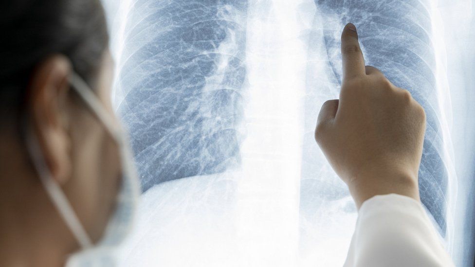 Universal cure for cancer not anytime soon, tumours have ‘almost infinite’ ability to evolve: Research