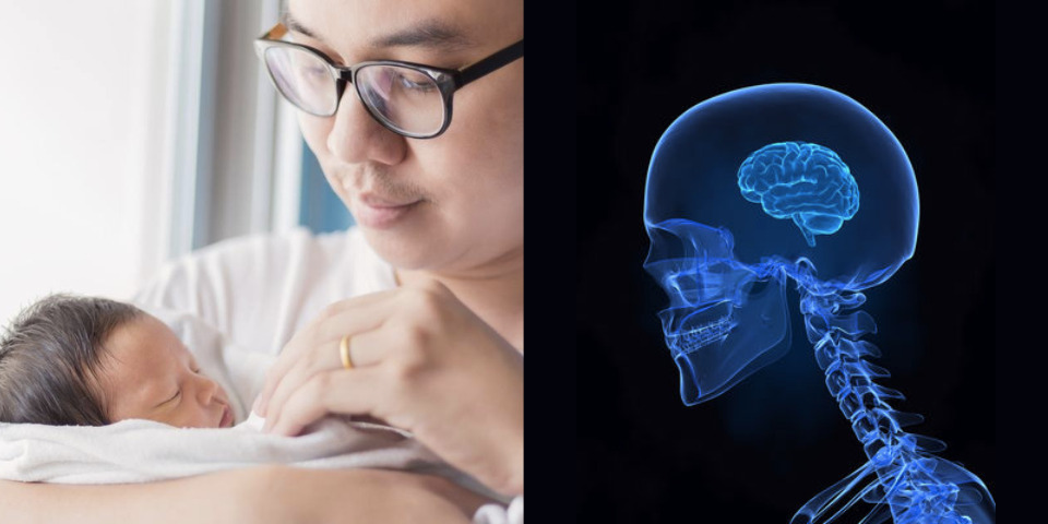 Brain shrinkage in first-time fathers: a study