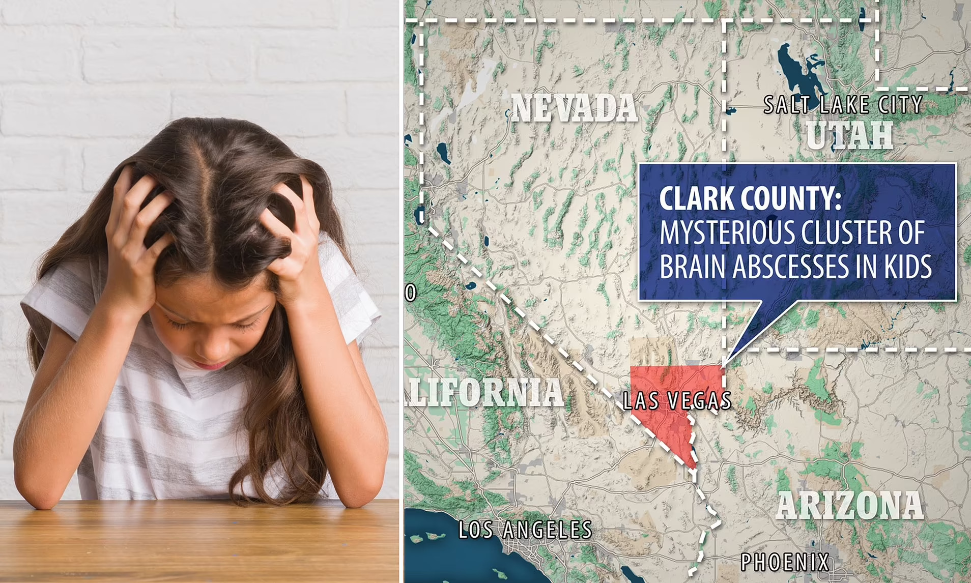After mysterious cluster of brain infections strikes children in southern Nevada, doctors on alert for any more cases