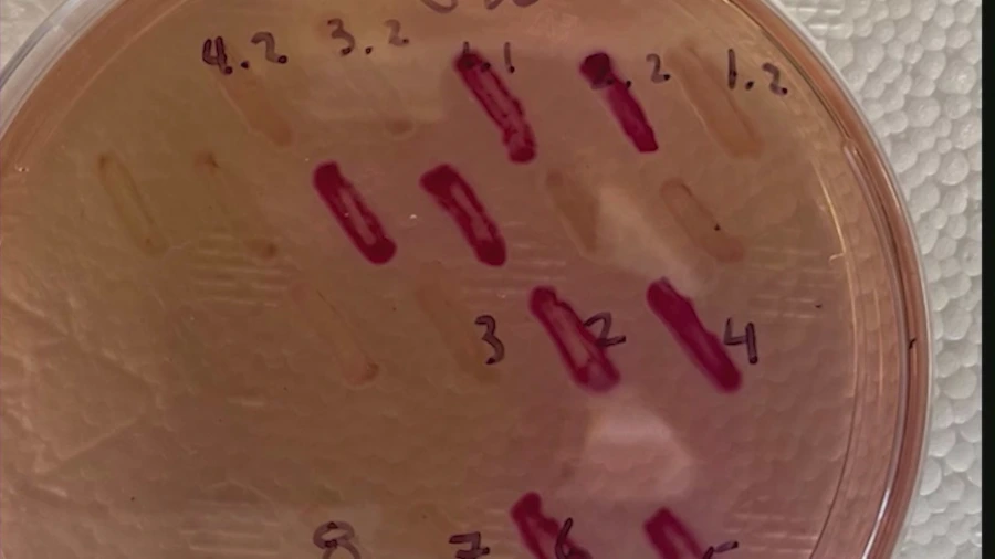Bacteria resistant to ‘last resort’ antibiotic discovered in Los Angeles for first time