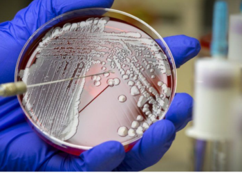Scientists use AI to discover new antibiotic to treat deadly superbug