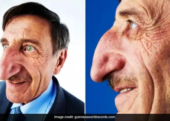 Man with the world’s longest nose, Mehmet Ozyurek, dies at 75