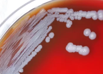 Warning Issued: Potentially dangerous bacteria found in the Gulf Coast of US