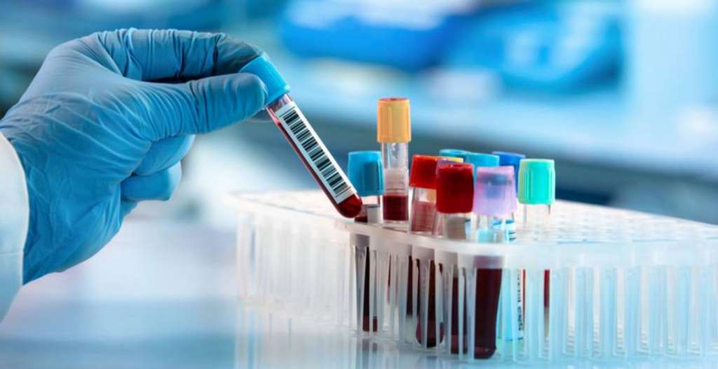 Groundbreaking: Multi-cancer blood test shows real promise in NHS study