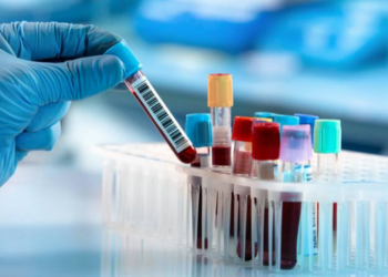 Groundbreaking: Multi-cancer blood test shows real promise in NHS study