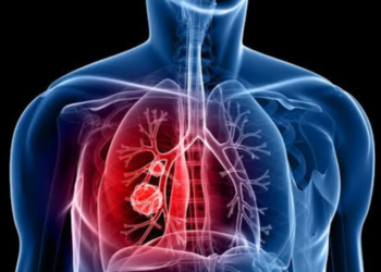 Lung cancer deaths cut in half with AstraZeneca pill