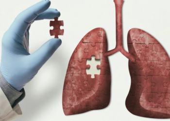 First AI-generated medicine enters human clinical trials