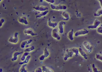Breezy Explainer: Everything to know about rare ‘brain-eating amoeba’ posing health concerns in US