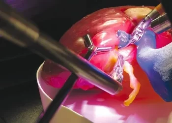 Surgery that doesn’t require an incision? Scientists create a revolutionary ultrasonic 3D printer