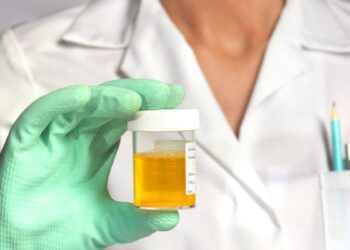 Research has finally solved the more than 150-year-old riddle of why pee is yellow