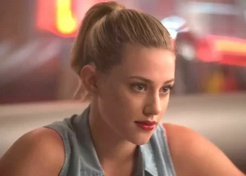 What is Alopecia Areata that the Riverdale Star Lili Reinhart is diagnosed with?