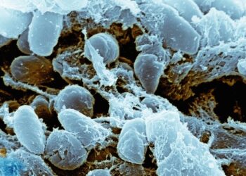 Bubonic Plague: What is it and what are its symptoms