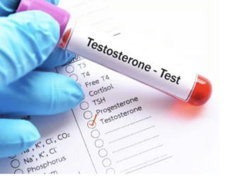 Who Requires a Testosterone Test?