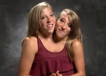 Conjoined twin Abby Hensel is now married
