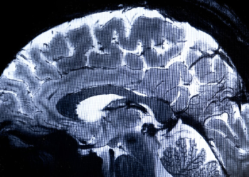 What is Iseult? The world’s most powerful MRI scans first images of the human brain