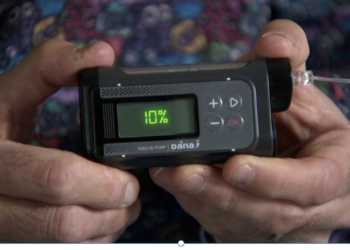 Game-changer: UK to provide artificial pancreas to people with type 1 diabetes