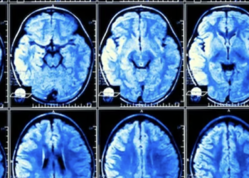 Human brain size increasing over successive generations: Study