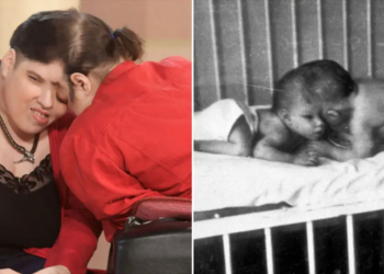 The world’s oldest conjoined twins, Lori and George Schappell, die at age 62