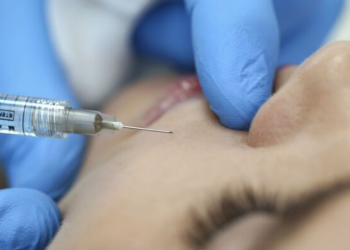 New Mexico: Spa shut down after “Vampire Facial” possibly transmitted HIV