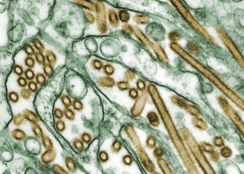 Third human case of bird flu outbreak reported in US