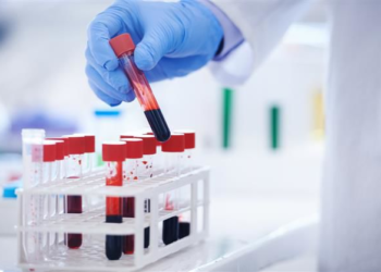 Blood test can detect rare forms of dementia and neurological diseases, study finds