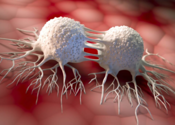 Half of US cancer deaths are preventable, alarming study says