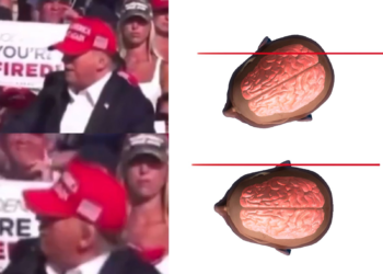 n a remarkable turn of events, former President Donald Trump narrowly escaped a bullet during a campaign rally in Butler, Pennsylvania. As Trump began his speech, gunshots rang out, and one bullet grazed his ear. Video footage reveals that a simple head tilt, mere seconds before the shot, saved him from the assassination attempt.