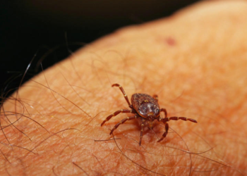 Man dies in Spain after contracting Crimean-Congo hemorrhagic fever from tick bite- Symptoms and prevention